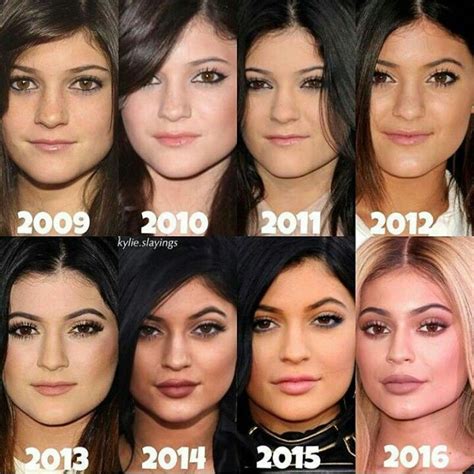 Kylie Jenner’s Transformation – Her Face & Body。